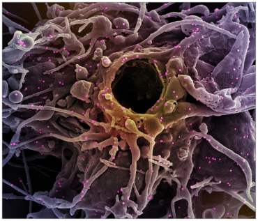 Researchers Tie Severe Immunosuppression to Chronic COVID-19 and Virus Variants