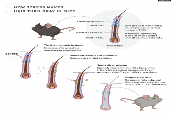 Scientists Discover How Stress Can Cause Gray Hair