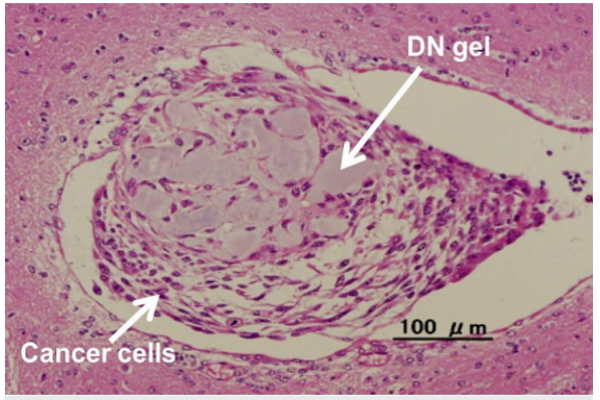 New research: Turning cancer cells into stem cells, helping to make medicines